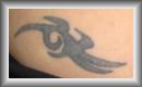 Tatouage � �liminer.
