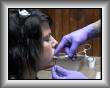 Pose d'un bouchon de li�ge contre les piq�res accidentelles